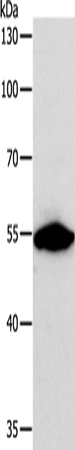 Anti-Human/Mouse/Rat CALR Antibody - ABMIUM
