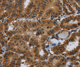 Anti-Human/Mouse/Rat Glucocorticoid Receptor Antibody - ABMIUM