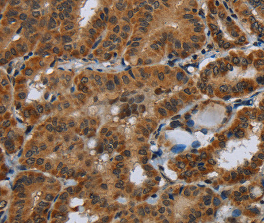 Anti-Human/Mouse/Rat Glucocorticoid Receptor Antibody - ABMIUM