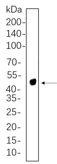 Anti-Human/Mouse/Rat NDRG1 Antibody [B602] - ABMIUM