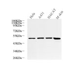 Western Blot analysis of various samples using CK-17 Polyclonal Antibody at dilution of 1:600.