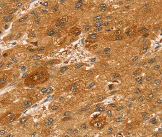 Anti-Human/Mouse/Rat STX2 Antibody