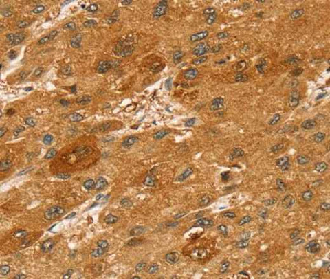 Anti-Human/Mouse/Rat STX2 Antibody
