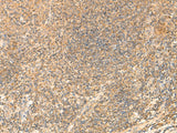 Immunohistochemistry of paraffin-embedded Human tonsil tissue using PDAP1 Polyclonal Antibody at dilution of 1:50(×200)