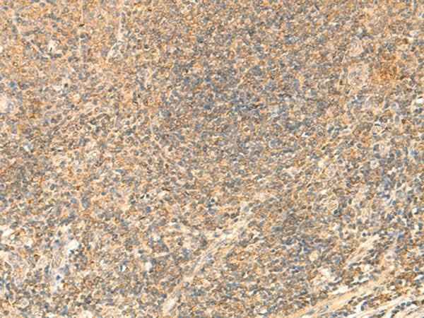 Anti-Human/Mouse/Rat PDAP1 Antibody