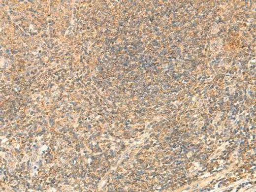 Anti-Human/Mouse/Rat PDAP1 Antibody