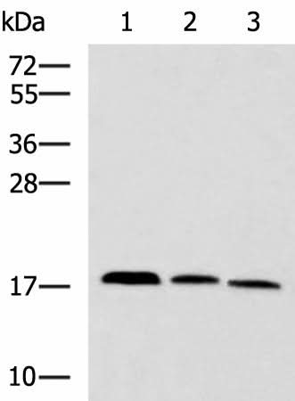 Western blot analysis of Mouse kidney tissue Rat brain tissue Mouse liver tissue lysates using CPLX3 Polyclonal Antibody at dilution of 1:950