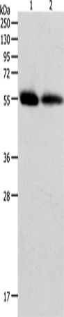Anti-Human/Mouse MMP11 Antibody - ABMIUM
