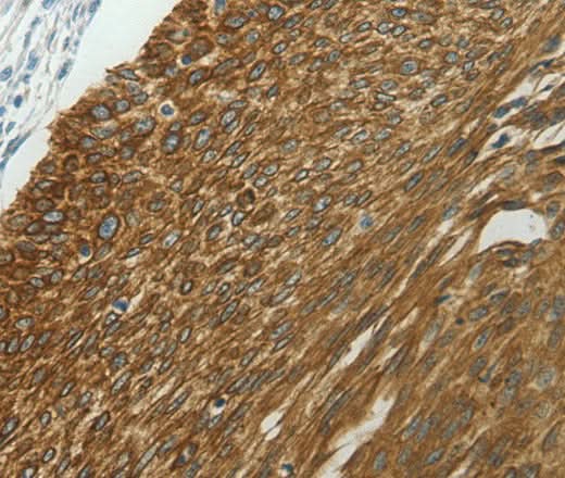 Anti-Human/Mouse/Rat NDRG2 Antibody - ABMIUM