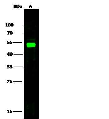 Anti-Human SELE Antibody [B243] - ABMIUM