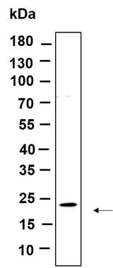 Anti-Human/Mouse/Rat Cofilin Antibody [B872]