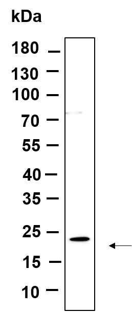 Anti-Human/Mouse/Rat Cofilin Antibody [B872] - ABMIUM
