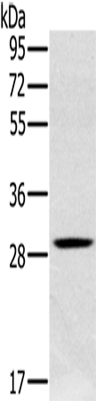 Anti-Human/Mouse/Rat CLIC1 Antibody - ABMIUM