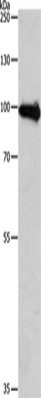 Anti-Human/Mouse APLP1 Antibody - ABMIUM