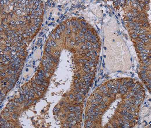 Anti-Human NDUFA1 Antibody