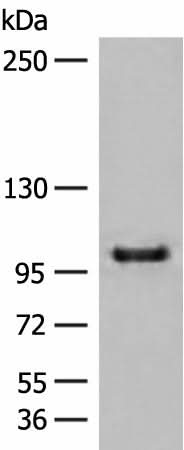 Anti-Human/Mouse CTDP1 Antibody - ABMIUM