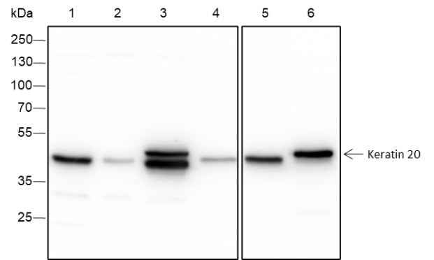 Anti-Human/Rat/Mouse Keratin 20 Antibody [A277]