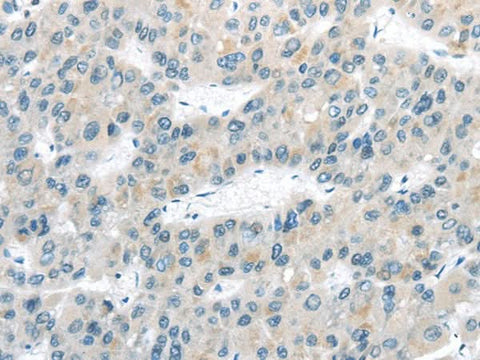 Anti-Human/Mouse/Rat VLDLR Antibody - ABMIUM