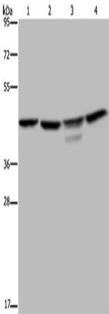 Anti-Human/Mouse/Rat CSNK2A1 Antibody - ABMIUM