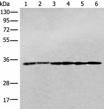 Western blot analysis of Jurkat cell Human breast cancer tissue Hela cell Human fetal brain tissue Human cerebrum tissue Rat brain tissue lysates using PITPNB Polyclonal Antibody at dilution of 1:400