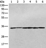 Western blot analysis of Jurkat cell Human breast cancer tissue Hela cell Human fetal brain tissue Human cerebrum tissue Rat brain tissue lysates using PITPNB Polyclonal Antibody at dilution of 1:400