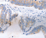 Anti-Human/Mouse/Rat SERP1 Antibody - ABMIUM