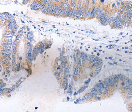 Anti-Human/Mouse/Rat SERP1 Antibody - ABMIUM