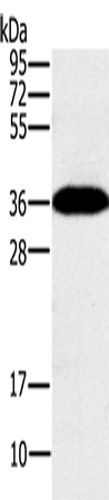 Anti-Human/Mouse/Rat PPP1CC Antibody - ABMIUM