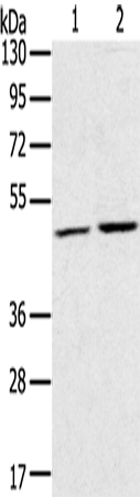 Anti-Human/Mouse RRAGC Antibody - ABMIUM