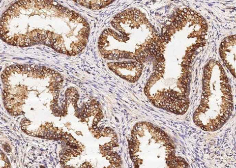 Anti-Human ENTPD5 Antibody [B143] - ABMIUM
