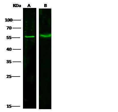 Anti-Human PRMT6 Antibody [A923] - ABMIUM