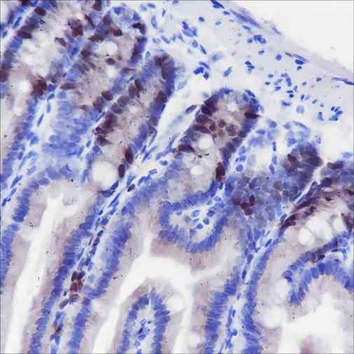 Anti-Human/Rat/Mouse TPX2 Antibody [A382]