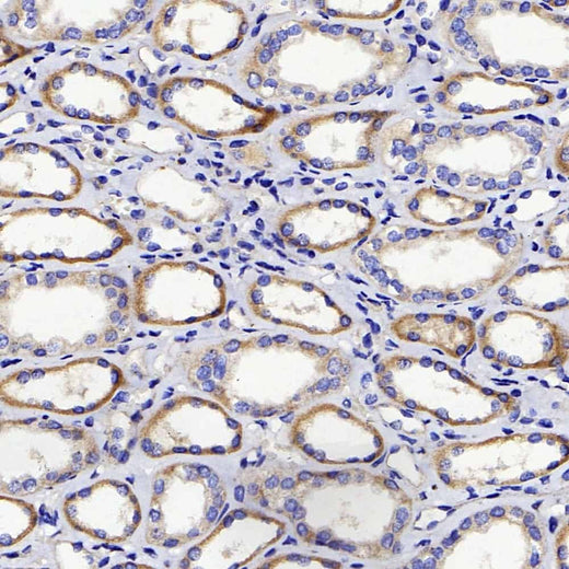 Immunohistochemistry analysis of paraffin-embedded human kidney using DICER1 Polyclonal Antibody at dilution of 1:400.