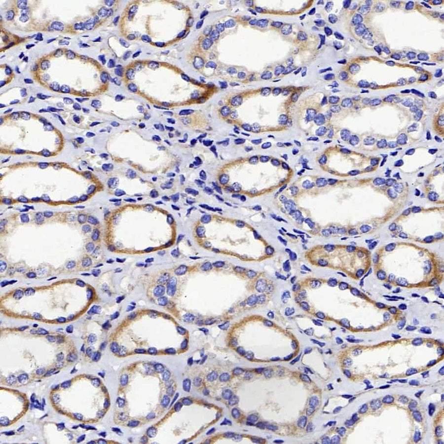 Immunohistochemistry analysis of paraffin-embedded human kidney using DICER1 Polyclonal Antibody at dilution of 1:400.