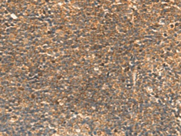 Immunohistochemistry of paraffin-embedded Human tonsil tissue using STK32C Polyclonal Antibody at dilution of 1:30(×200)