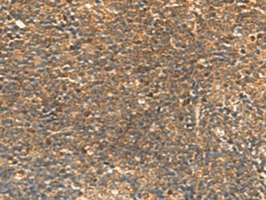 Immunohistochemistry of paraffin-embedded Human tonsil tissue using STK32C Polyclonal Antibody at dilution of 1:30(×200)