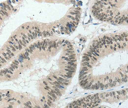 Anti-Human/Mouse/Rat HNF1B Antibody