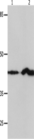 Anti-Human/Mouse/Rat IRF1 Antibody - ABMIUM