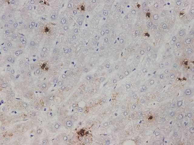 Anti-Human IL1A Antibody