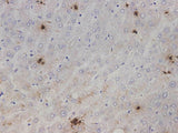 Immunohistochemistry of paraffin-embedded Human liver tissue using IL1A Polyclonal Antibody at dilution of 1:2000(×400)
