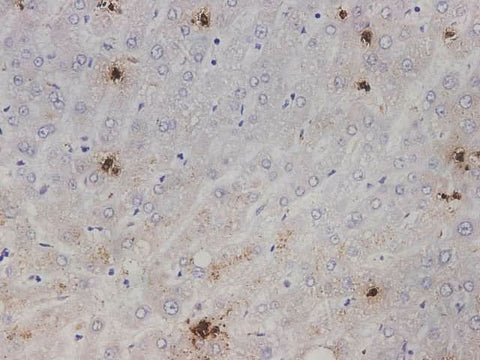 Immunohistochemistry of paraffin-embedded Human liver tissue using IL1A Polyclonal Antibody at dilution of 1:2000(×400)