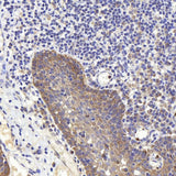 Immunohistochemistry analysis of paraffin-embedded human tonsil using PERK Polyclonal Antibody at dilution of 1:400.