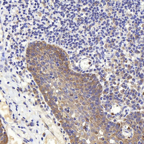 Immunohistochemistry analysis of paraffin-embedded human tonsil using PERK Polyclonal Antibody at dilution of 1:400.