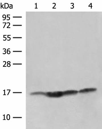Western blot analysis of Human prostate tissue Jurkat cell Hela and HL-60 cell lysates using MAGOHB Polyclonal Antibody at dilution of 1:400