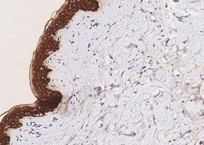 Anti-Human KRT5 Antibody [A1223] - ABMIUM