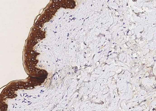 Anti-Human KRT5 Antibody [A1223] - ABMIUM