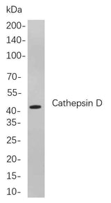 Anti-Human/Mouse/Rat Cathepsin D Antibody [B769]