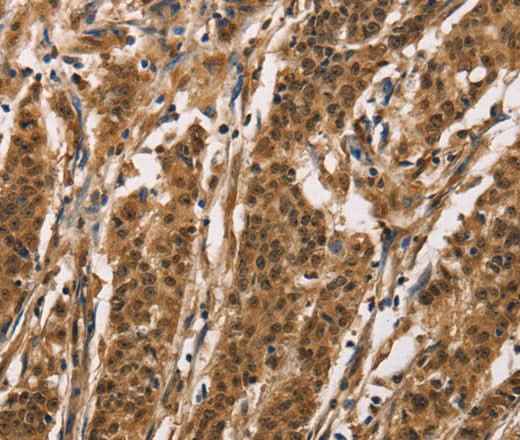 Anti-Human/Mouse/Rat ADGRB1 Antibody