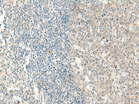 Immunohistochemistry of paraffin-embedded Human tonsil tissue using NPBWR1 Polyclonal Antibody at dilution of 1:50(×200)