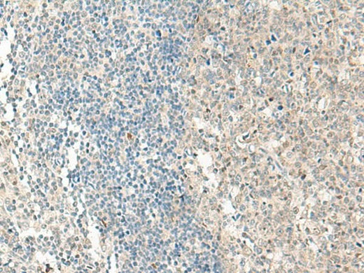 Immunohistochemistry of paraffin-embedded Human tonsil tissue using NPBWR1 Polyclonal Antibody at dilution of 1:50(×200)